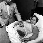 Mrs. Hodges shows her bruise