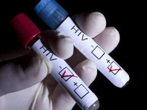 Test HIV