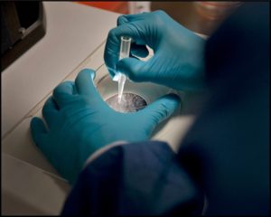 Yescarta, il secondo trattamento CAR-T approvato dalla FDA