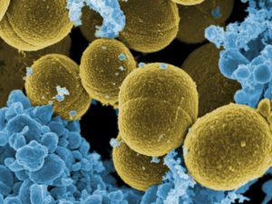 MRSA, forse identificata una nuova arma