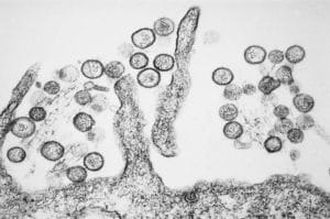 cos'è l'Hantavirus