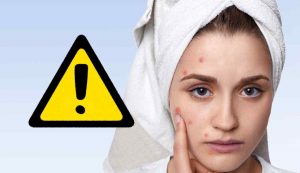 Pericolo acne
